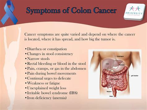 colon cancer symptoms in men over 50